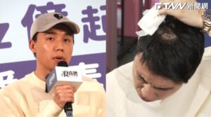Toyz挨揍現身做公益！掀紗布秀「11cm頭疤」　恐怖傷勢曝光